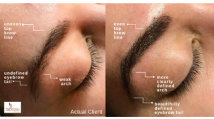 Before and After Results of Microblading Actual Client